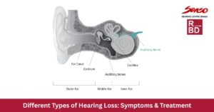 different types of hearing loss